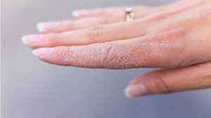 علل انواع مختلف ترک های پوستی