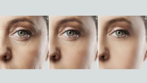 تاثیر تغذیه و آب بدن بر موفقیت لیزر جای جوش و لک