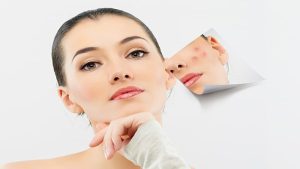 لیزر جای جوش دائمی است یا موقتی؟ | لیزر جای جوش در تهران | دکتر مهدی سبکتکین